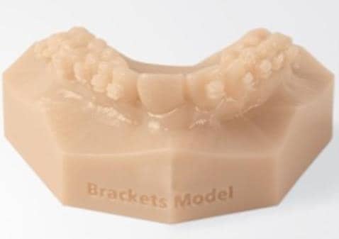 Stratasys VeroDentPlus alapanyagból 3D nyomtatott fogászati modell
