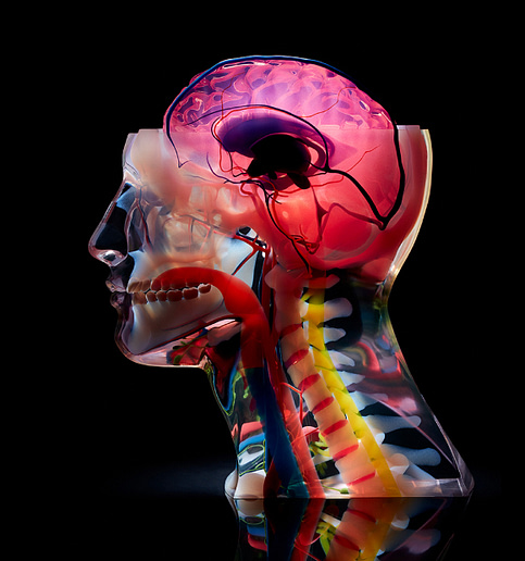 3D nyomtatott anatómiai modell