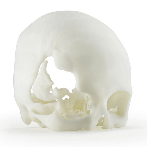 ABS-MSi 3D nyomtatott koponya modell