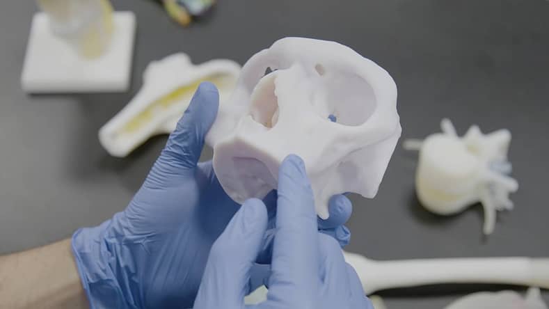 3D nyomtatott orvosi modell